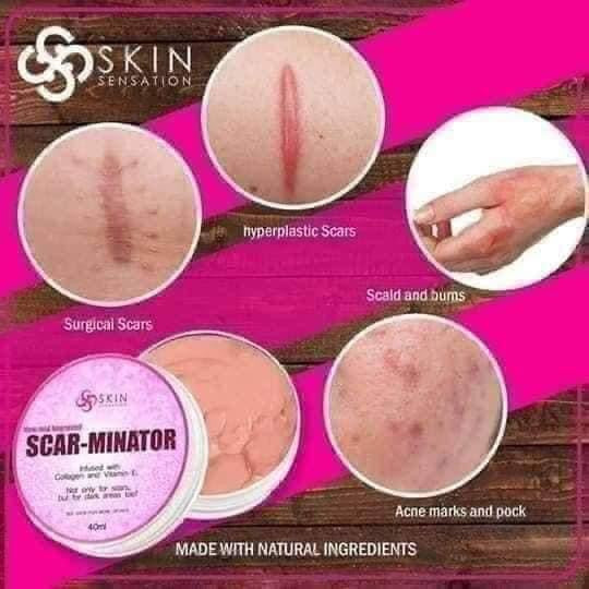 SCARMINATOR CREAM
