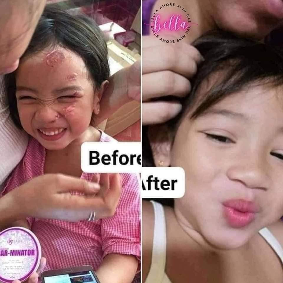 SCARMINATOR CREAM